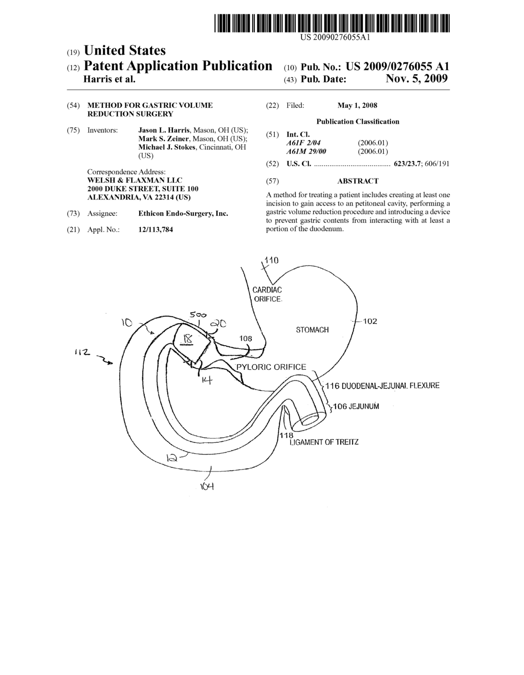 METHOD FOR GASTRIC VOLUME REDUCTION SURGERY - diagram, schematic, and image 01