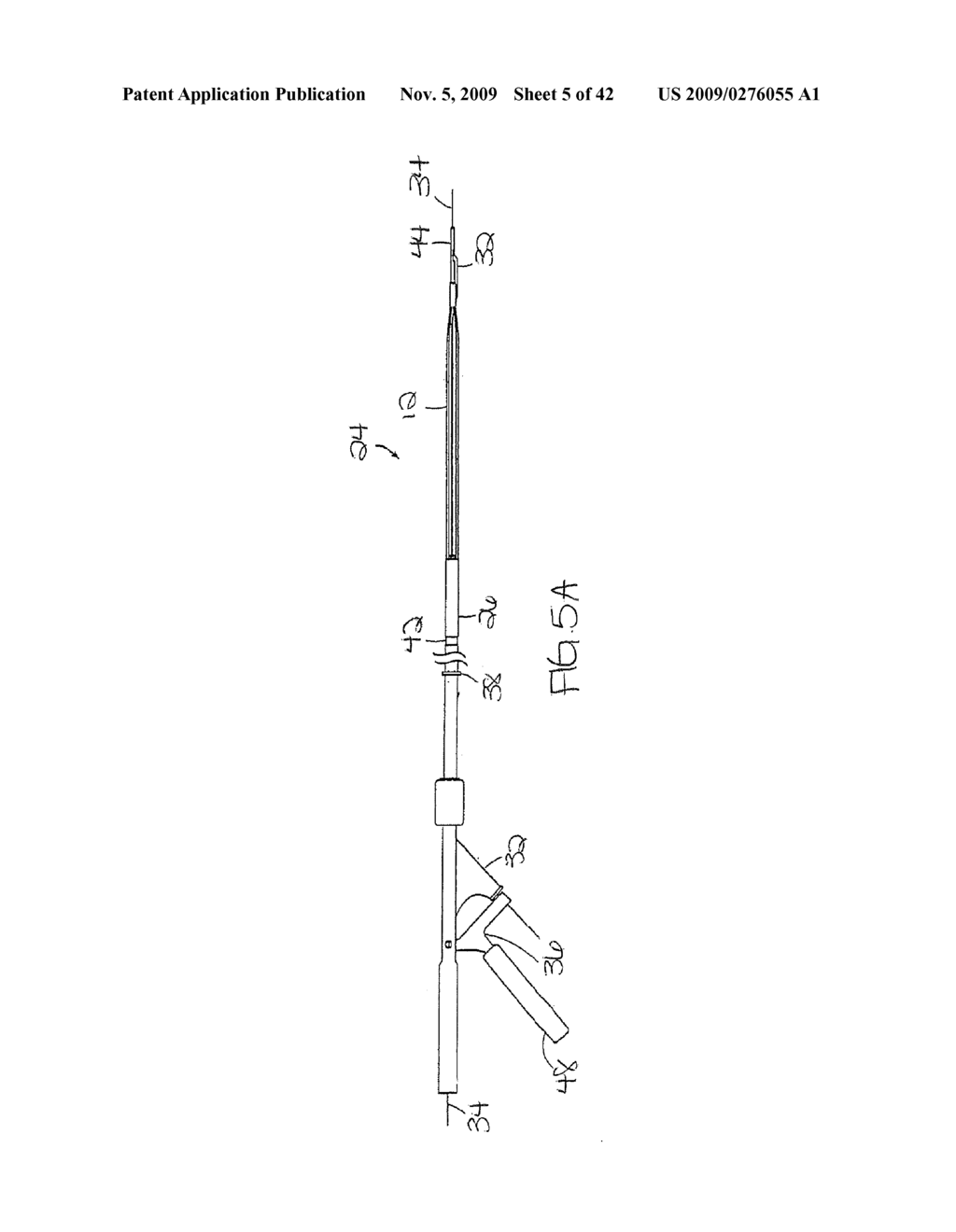 METHOD FOR GASTRIC VOLUME REDUCTION SURGERY - diagram, schematic, and image 06