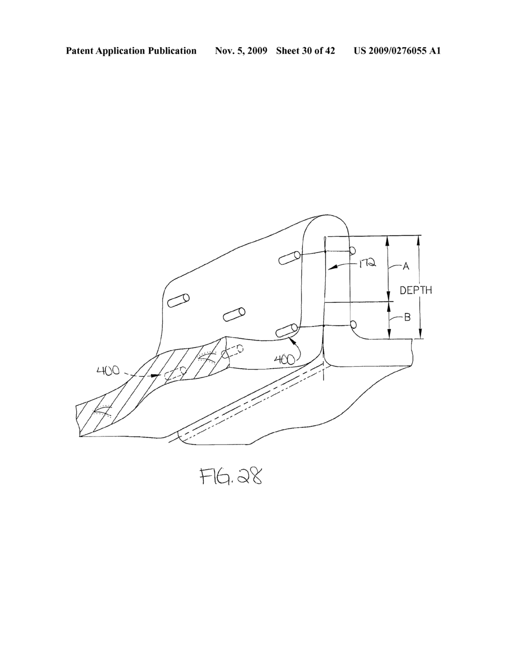 METHOD FOR GASTRIC VOLUME REDUCTION SURGERY - diagram, schematic, and image 31