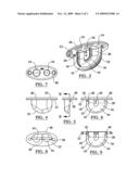 Flush cleat diagram and image