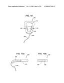 ADJUSTABLE VAGINAL SPLINT FOR PELVIC FLOOR SUPPORT diagram and image