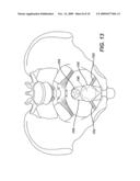 ADJUSTABLE VAGINAL SPLINT FOR PELVIC FLOOR SUPPORT diagram and image