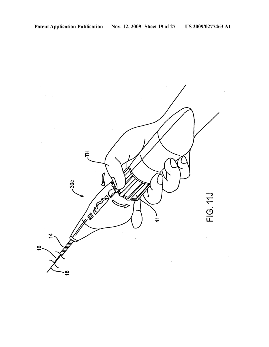 Deployment Actuation System for Intrafallopian Contraception - diagram, schematic, and image 20