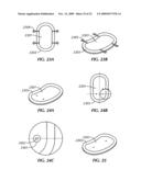 3-Dimensional Curved Substrate Lamination diagram and image