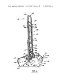 Uprightly Storable Fecal Matter Scooper diagram and image