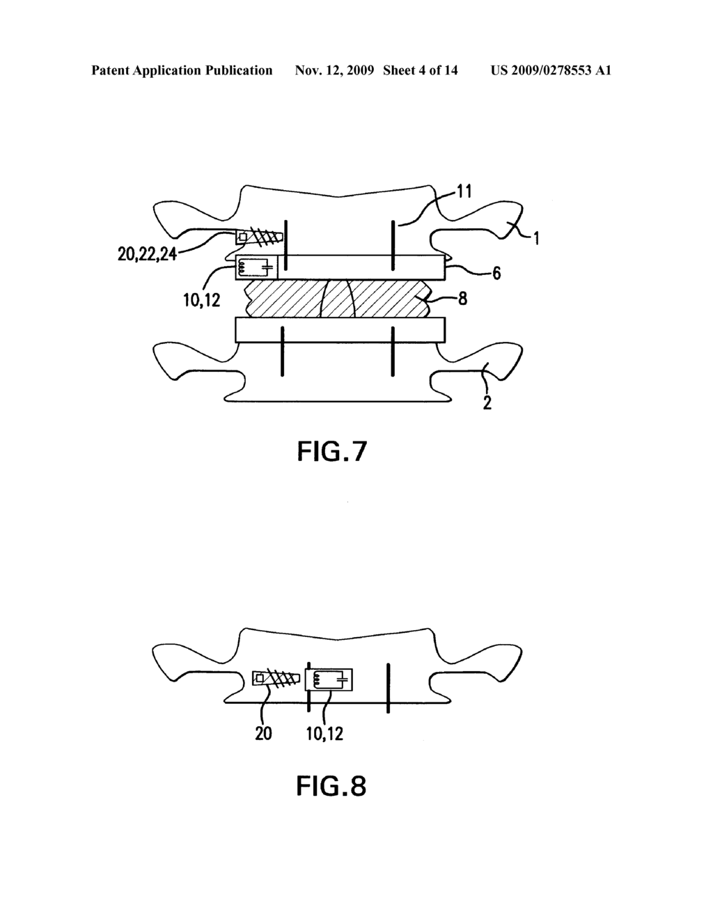 SYSTEM AND APPARATUS FOR IN-VIVO ASSESSMENT OF RELATIVE POSITION OF AN IMPLANT - diagram, schematic, and image 05