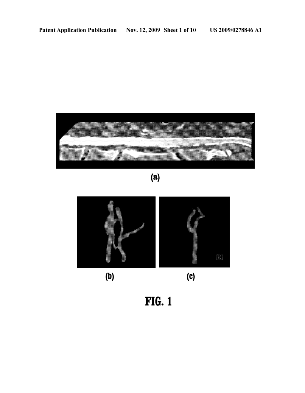 SYSTEM AND METHOD FOR GEOMETRIC MODELING OF TUBULAR STRUCTURES - diagram, schematic, and image 02