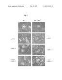 CELL CULTURE OF KERATINOCYTES UNDER NON-DIFFERENTIATING CONDITIONS diagram and image