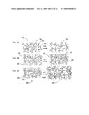 Devices for the treatment of wounds and methods and kits therefor diagram and image