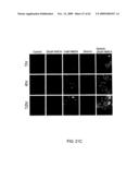 Method of Reducing Injury to Mammalian Cells diagram and image