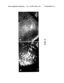 COMPOSITIONS AND METHODS RELATED TO MIRNA MODULATION OF NEOVASCULARIZATION OR ANGIOGENESIS diagram and image