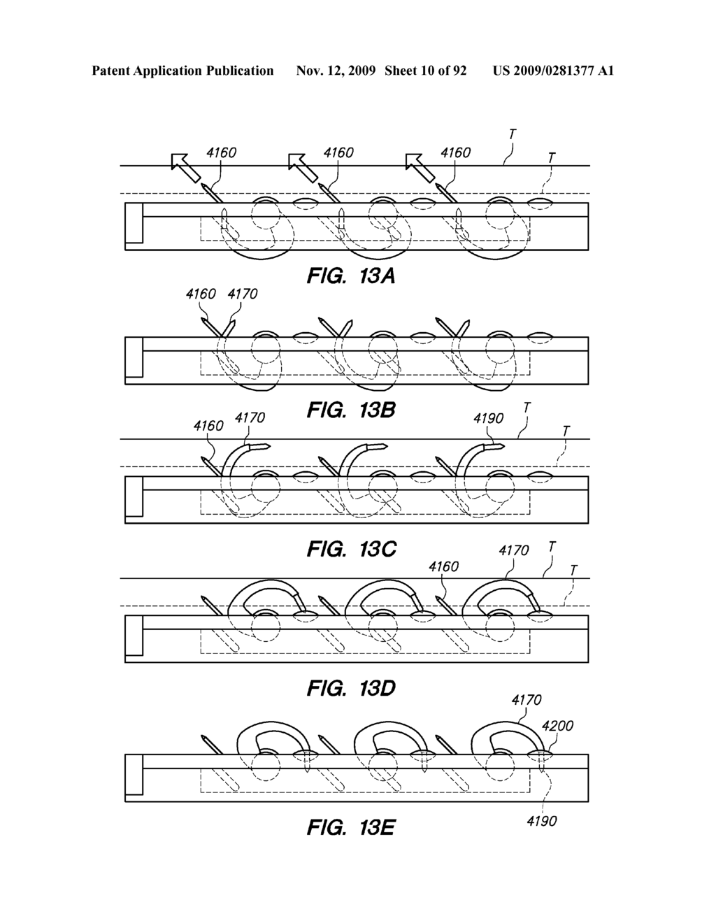 DEVICES, TOOLS AND METHODS FOR PERFORMING MINIMALLY INVASIVE ABDOMINAL SURGICAL PROCEDURES - diagram, schematic, and image 11