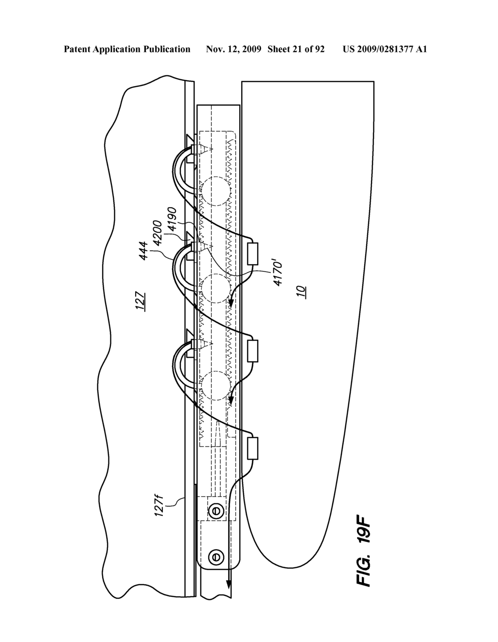 DEVICES, TOOLS AND METHODS FOR PERFORMING MINIMALLY INVASIVE ABDOMINAL SURGICAL PROCEDURES - diagram, schematic, and image 22