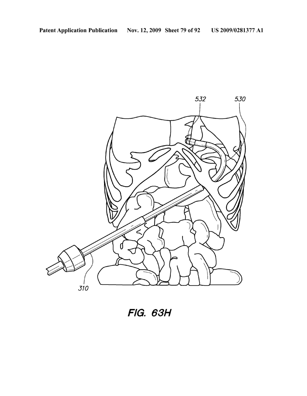 DEVICES, TOOLS AND METHODS FOR PERFORMING MINIMALLY INVASIVE ABDOMINAL SURGICAL PROCEDURES - diagram, schematic, and image 80