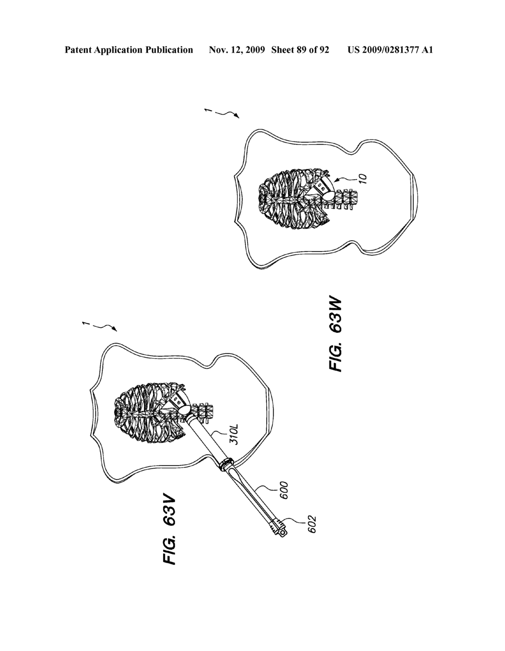 DEVICES, TOOLS AND METHODS FOR PERFORMING MINIMALLY INVASIVE ABDOMINAL SURGICAL PROCEDURES - diagram, schematic, and image 90