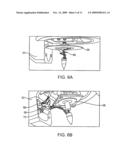 HAND-HELD ELECTRIC FIELD IMAGER FOR MEASURING THE ELECTRIC FIELD IN MAMMALIAN SKIN AND OTHER EPITHELIAL STRUCTURES diagram and image