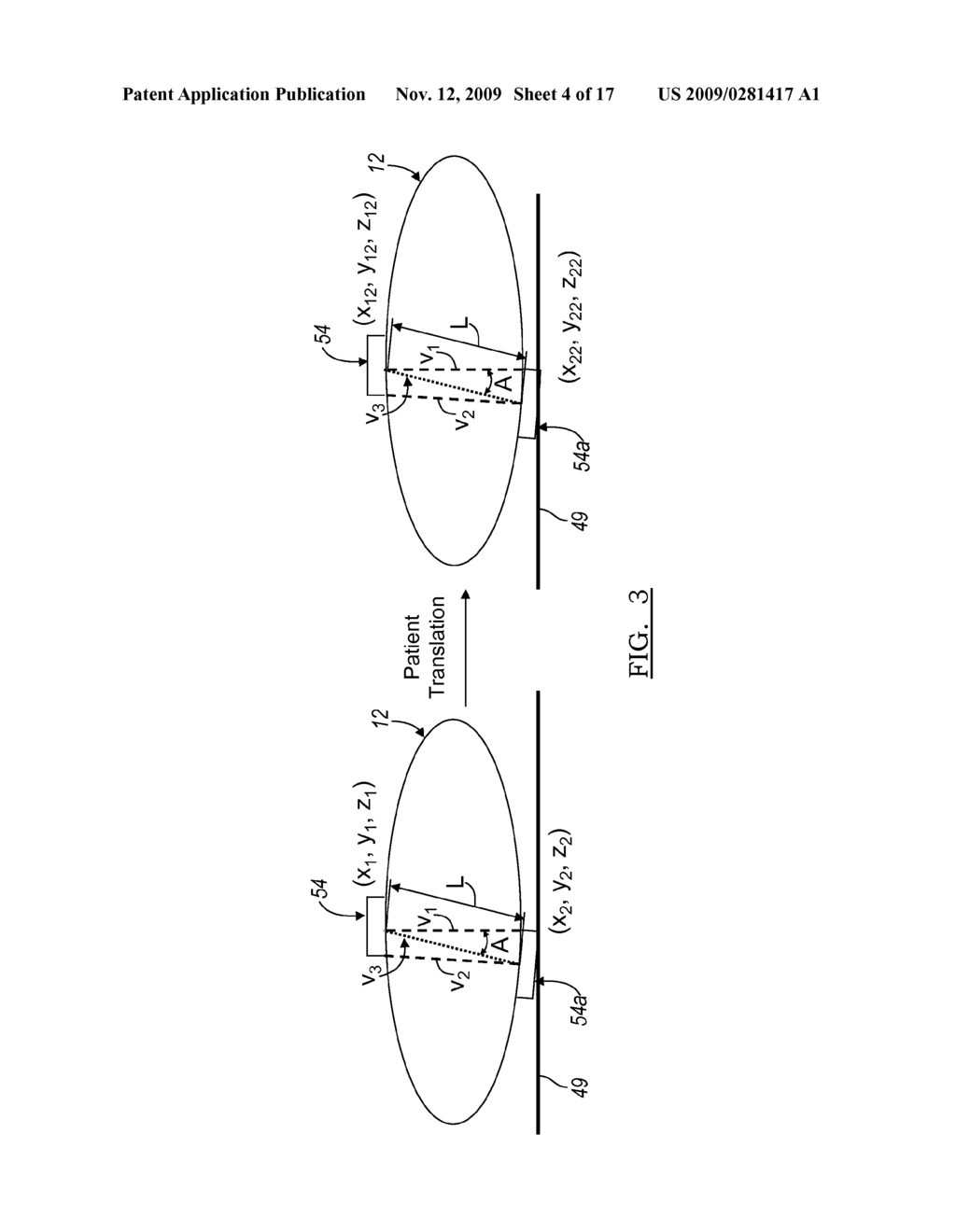 Method and apparatus for tracking a patient - diagram, schematic, and image 05