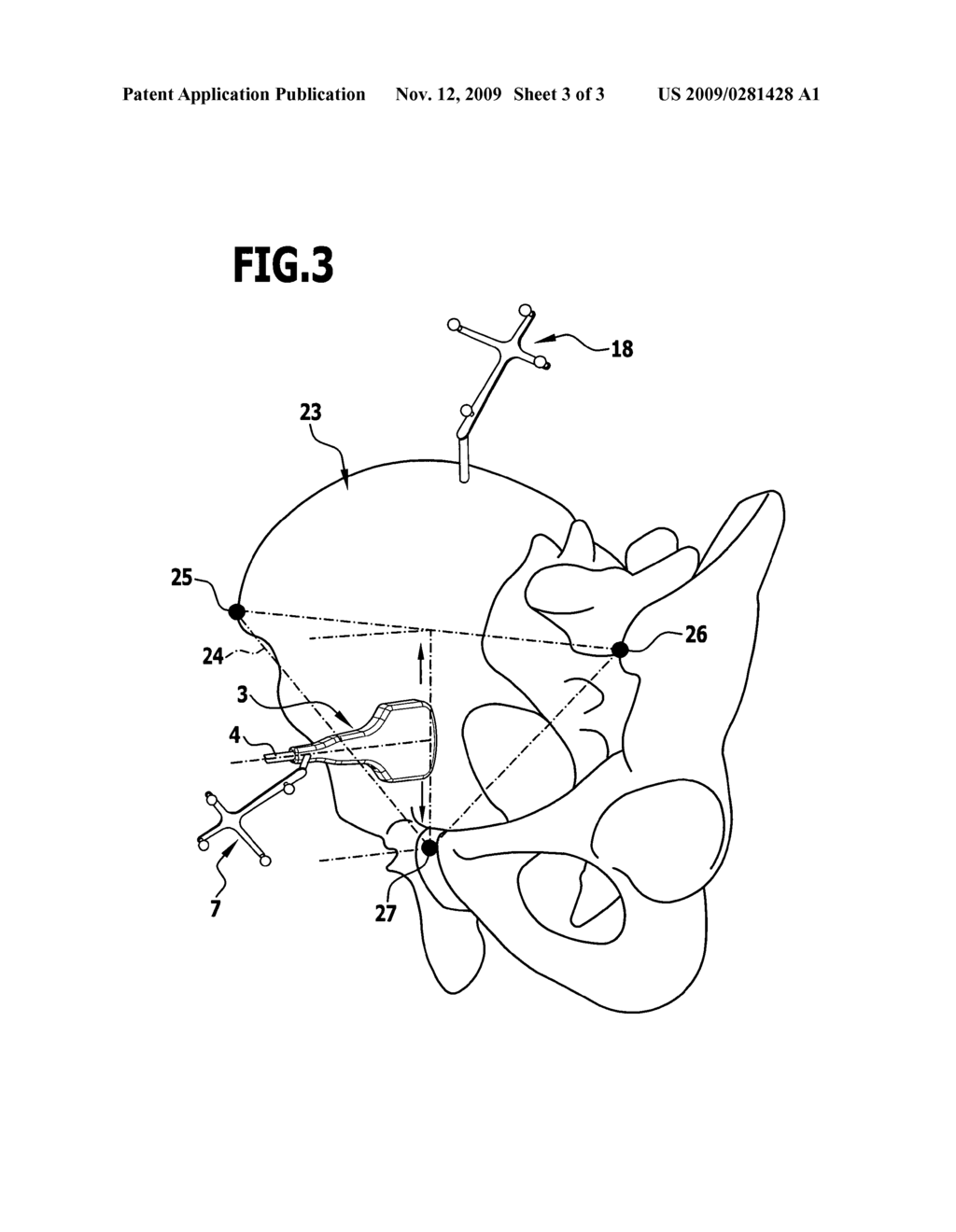 Method and apparatus for examining a body with an ultrasound head - diagram, schematic, and image 04