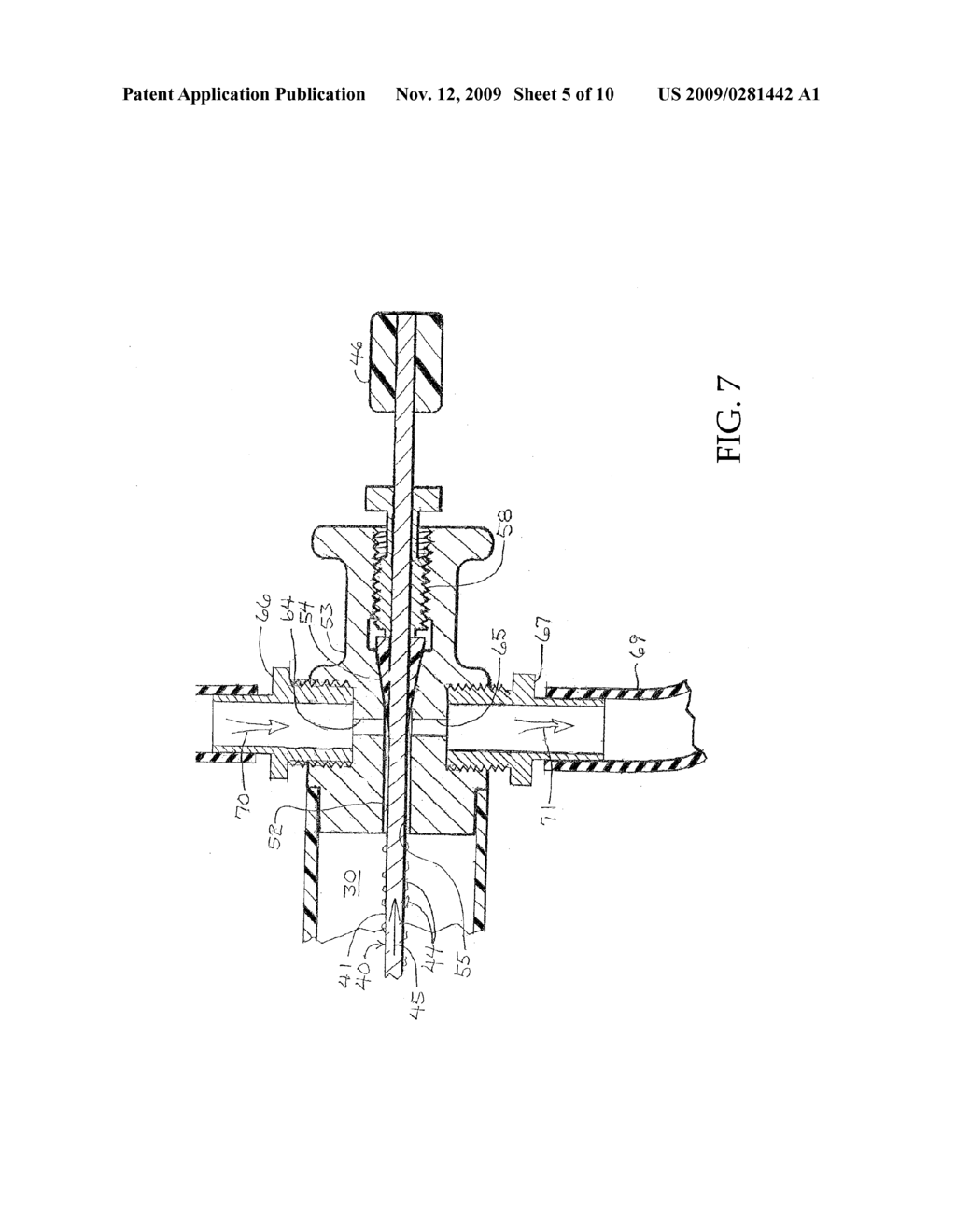 BREATH AEROSOL MANAGEMENT AND COLLECTION SYSTEM - diagram, schematic, and image 06