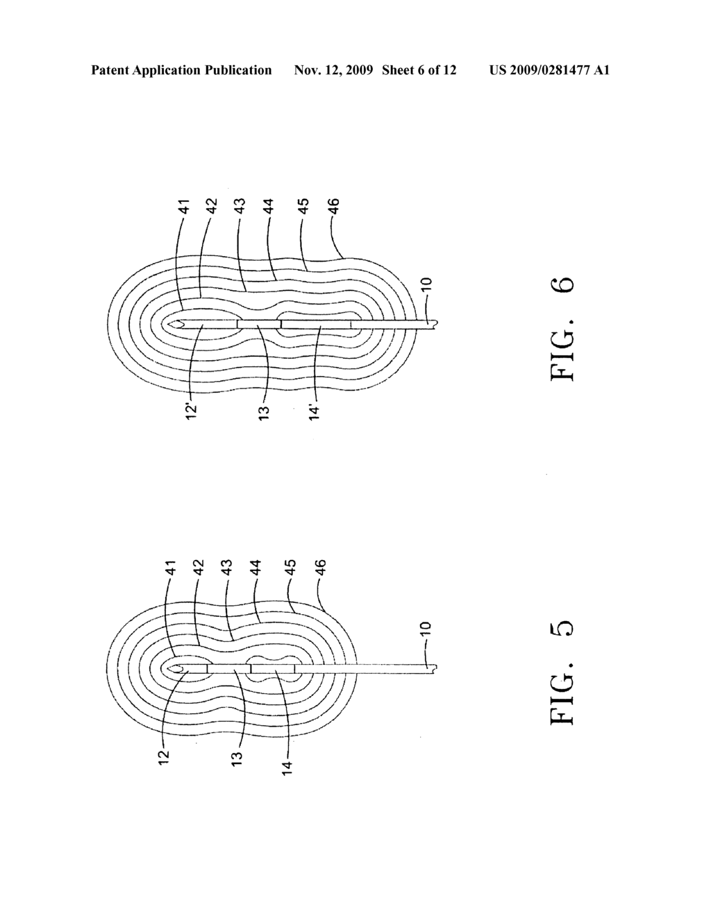 ELECTROPORATION DEVICE AND METHOD - diagram, schematic, and image 07