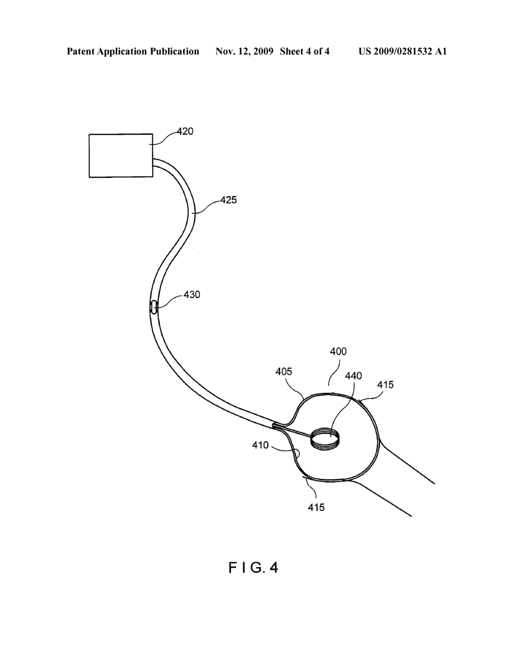 ARRANGEMENT FOR USE WITH A BALLOON ABLATION CATHETER - diagram, schematic, and image 05