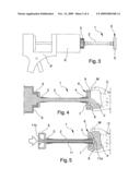 DEVICE FOR FILLING BONE CAVITIES WITH FLUID CEMENT, ACETABULAR CAVITIES IN PARTICULAR diagram and image