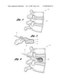 BONE CEMENT MIXING AND DELIVERY DEVICE AND METHOD OF USE diagram and image