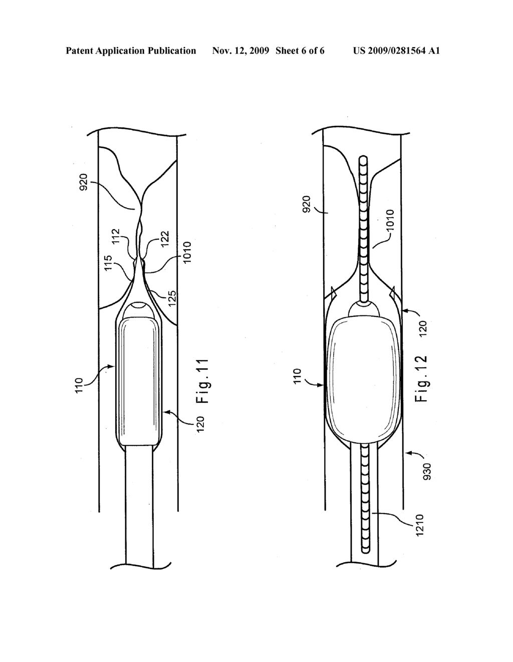 Pre-Clot Vessel Dilator - diagram, schematic, and image 07