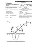 Gliding Stitch for Closing Wounds Under Tension diagram and image