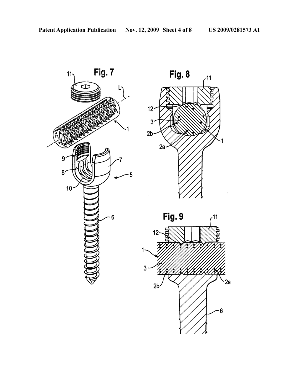 ROD-SHAPED IMPLANT, IN PARTICULAR FOR THE DYNAMIC STABILIZATION OF THE SPINE - diagram, schematic, and image 05