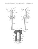 ULNAR HEAD PROSTHESIS SYSTEM diagram and image