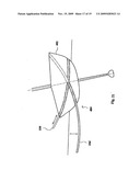 MONOHULL SAILING VESSEL HAVING A LIFTING HYDROFOIL diagram and image