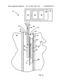 SEISMIC WAVE GENERATION SYSTEMS AND METHODS FOR CASED WELLS diagram and image