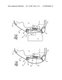 INTEGRAL PELVIC IMPACT ENERGY-ABSORBING PRE-CRUSH PROTECTIVE CONSTRUCTION FOR VEHICLE DOOR diagram and image