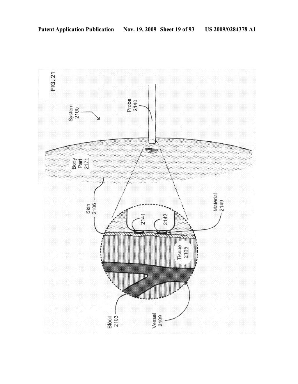 Circulatory monitoring systems and methods - diagram, schematic, and image 20