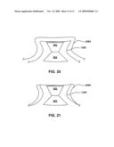 DEVICE HAVING SIDEGAP AND METHOD FOR FABRICATING SAME diagram and image