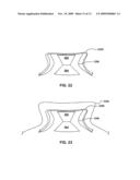 DEVICE HAVING SIDEGAP AND METHOD FOR FABRICATING SAME diagram and image