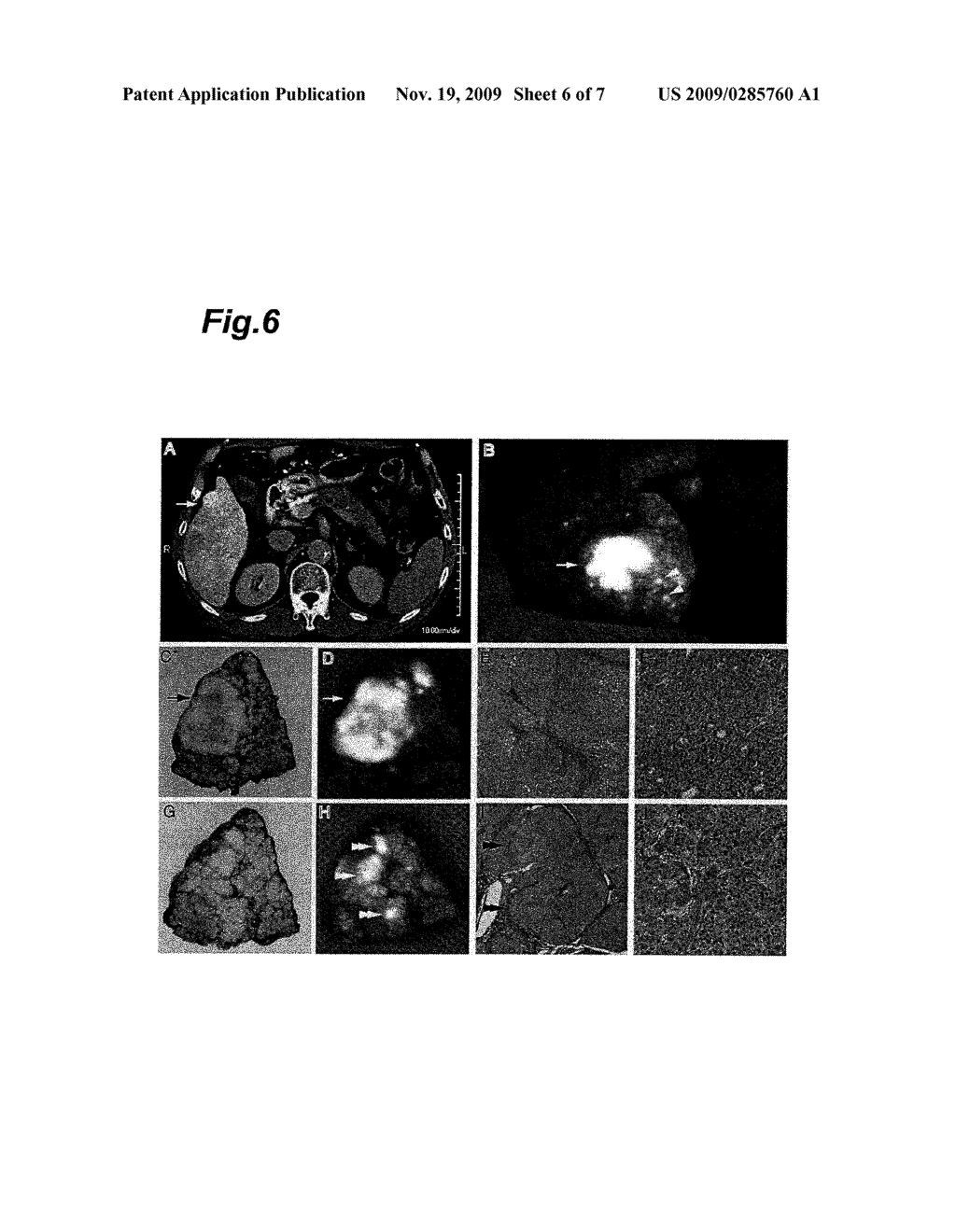 METHOD FOR DETECTING CANCER USING ICG FLUORESCENCE METHOD - diagram, schematic, and image 07