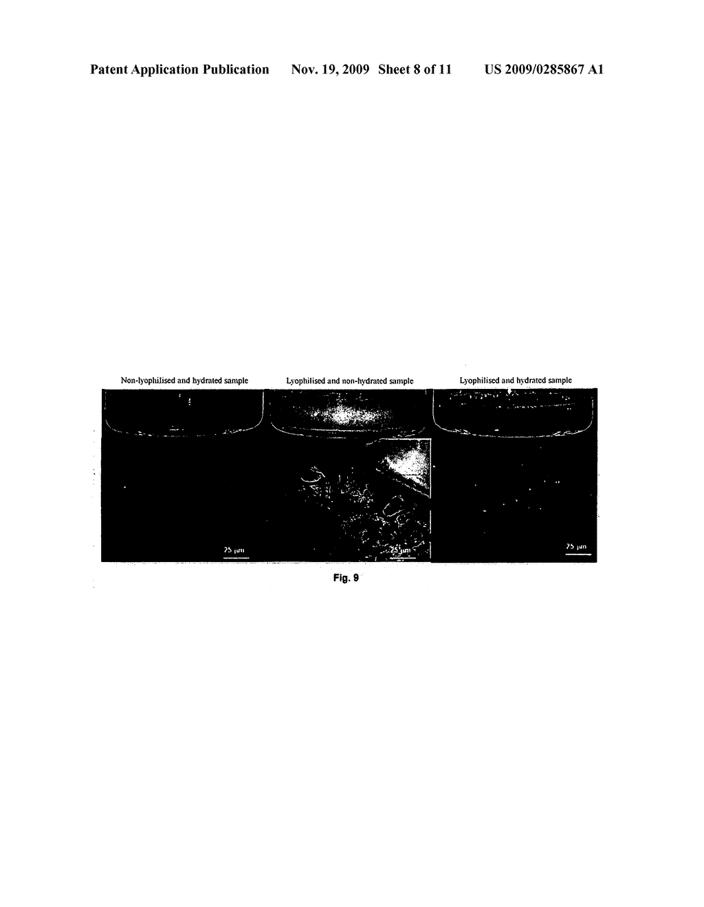 METHOD FOR EXTEMPORANEOUS AND REVERSIBLE CONCENTRATION OF LIPOSOMES - diagram, schematic, and image 09