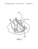 VALUE WHOLE POULTRY PRODUCT AND METHOD FOR MANUFACTURE diagram and image