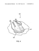 VALUE WHOLE POULTRY PRODUCT AND METHOD FOR MANUFACTURE diagram and image