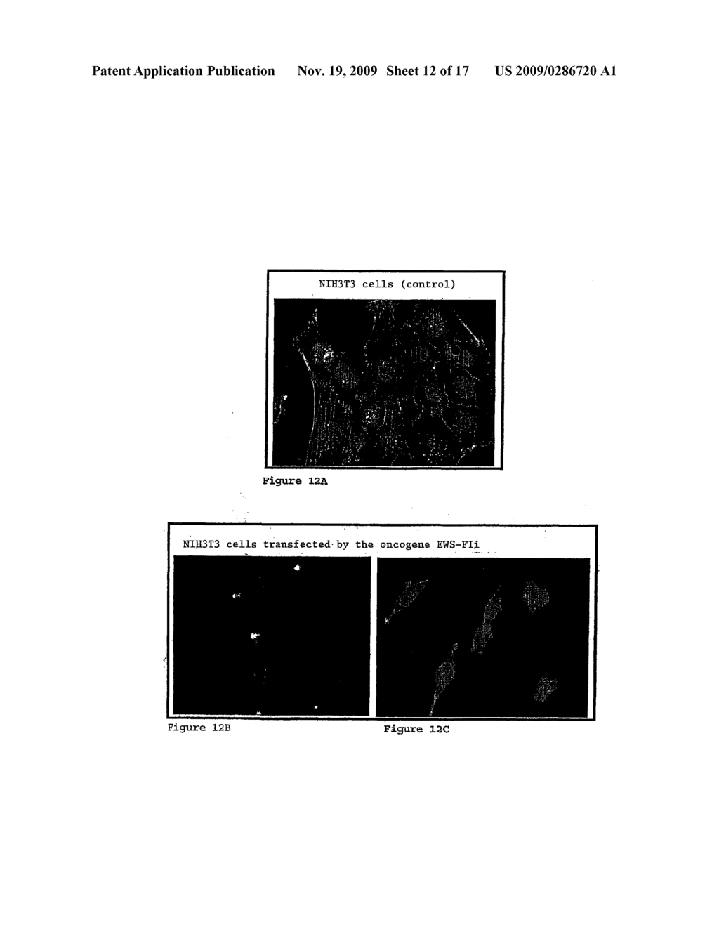PHARMACEUTICAL COMPOSITION FOR THE DIAGNOSIS, PREVENTION OR TREATMENT OF A TUMORAL PATHOLOGY COMPRISING AN AGENT MODULATING THE POLYMERIZATION STATE OF ACTIN - diagram, schematic, and image 13