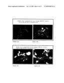 PHARMACEUTICAL COMPOSITION FOR THE DIAGNOSIS, PREVENTION OR TREATMENT OF A TUMORAL PATHOLOGY COMPRISING AN AGENT MODULATING THE POLYMERIZATION STATE OF ACTIN diagram and image