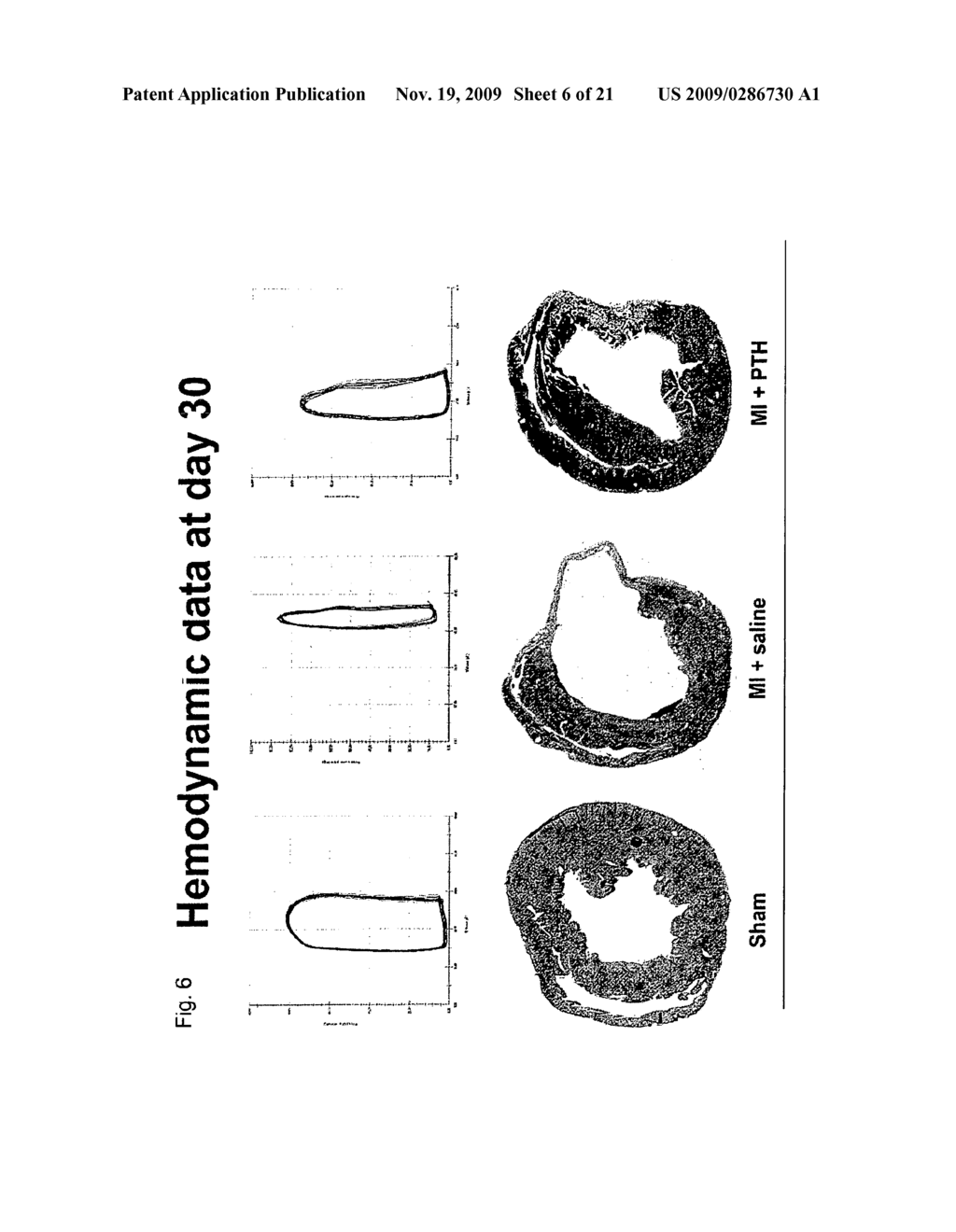 REMEDIES FOR ISCHEMIA - diagram, schematic, and image 07