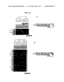 Method of Diagnosing Breast Cancer diagram and image