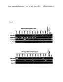 Method of Diagnosing Breast Cancer diagram and image