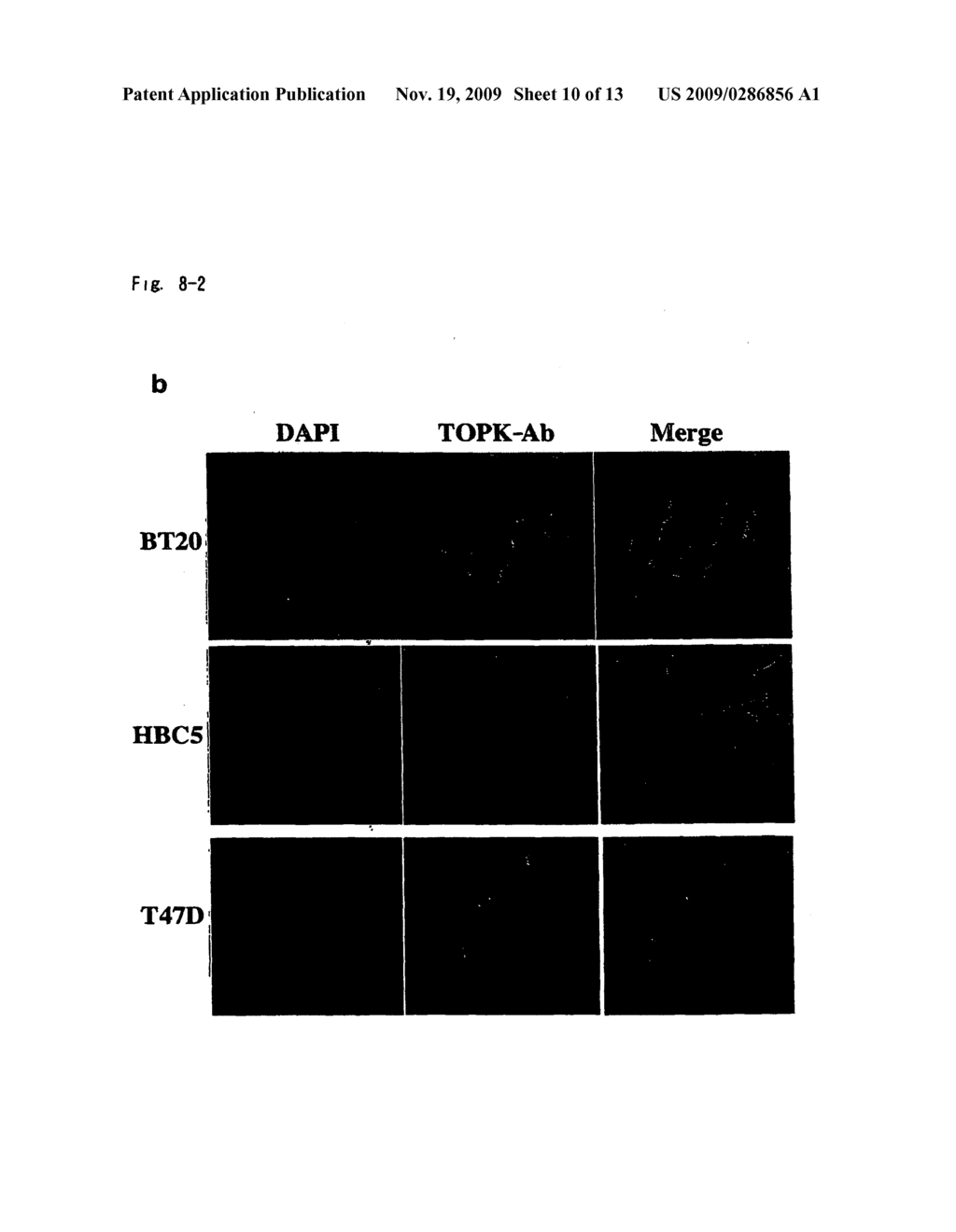 Method of Diagnosing Breast Cancer - diagram, schematic, and image 11