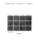 POTENT LNA OLIGONUCLEOTIDES FOR THE INHIBITION OF HIF-1a EXPRESSION diagram and image