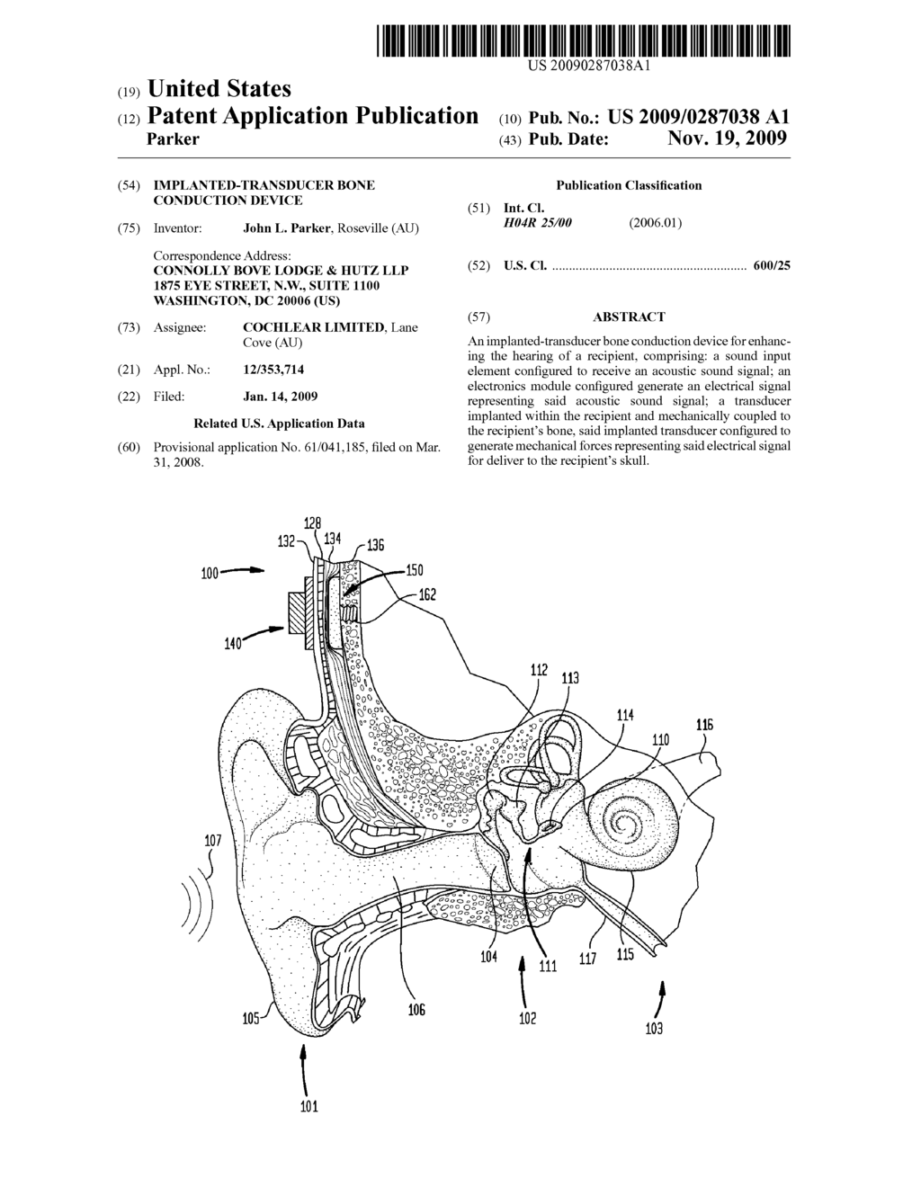 IMPLANTED-TRANSDUCER BONE CONDUCTION DEVICE - diagram, schematic, and image 01