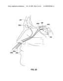 Method and apparatus for imaging within a living body diagram and image